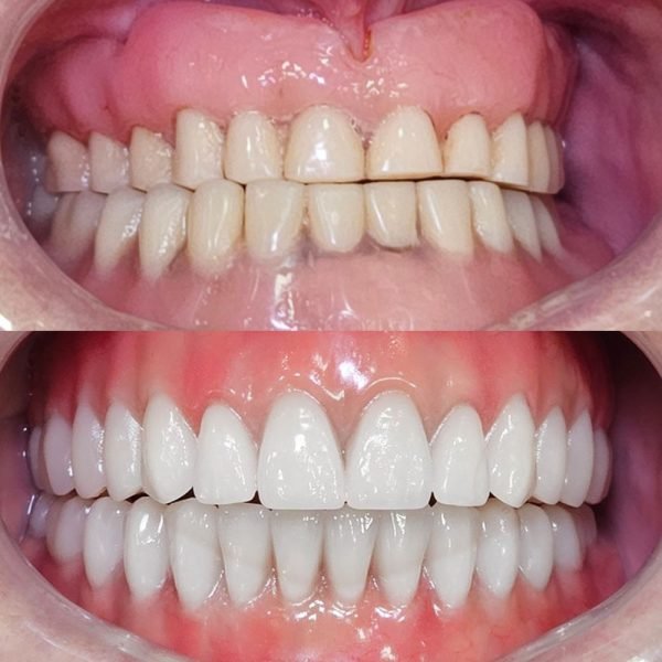 antes-depois-1.jpg