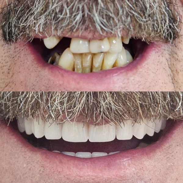 antes-depois-3.jpg