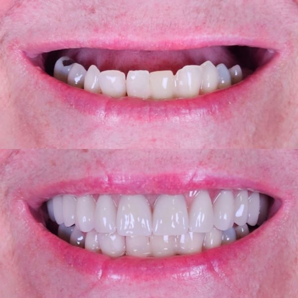 antes-depois-4.jpg