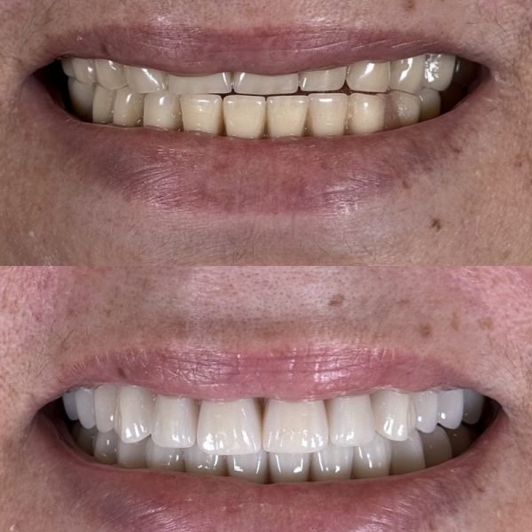 antes-depois-5